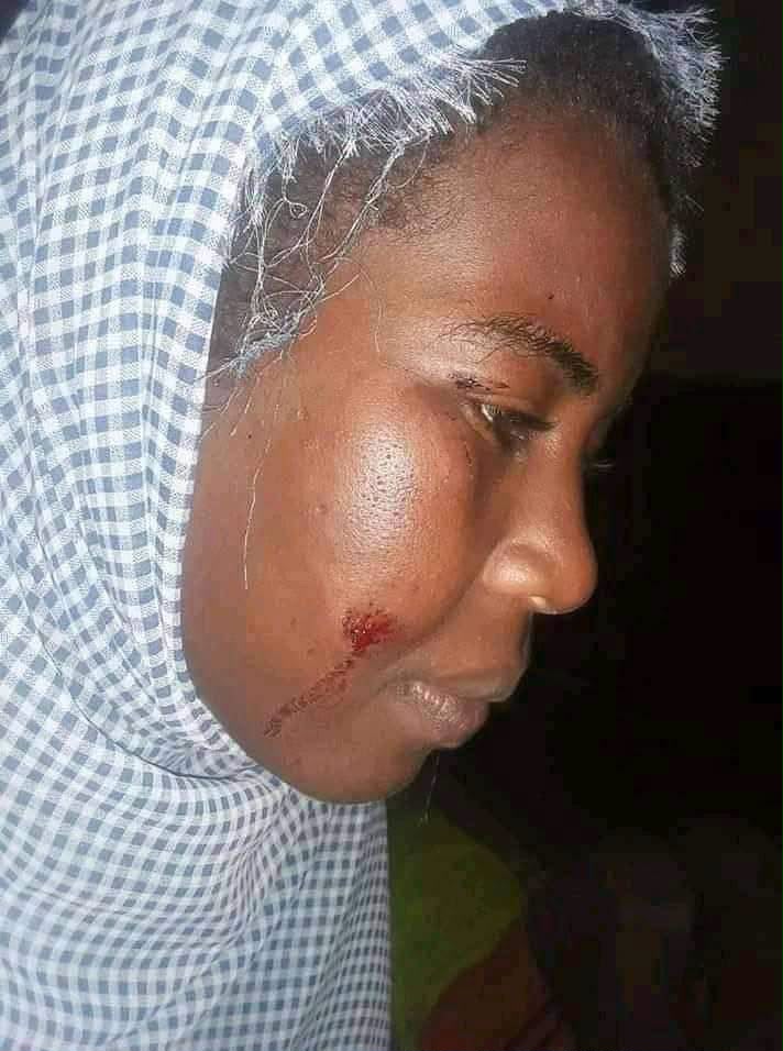 Violences basées sur le genre : le récit poignant de Farah Abderrahmane